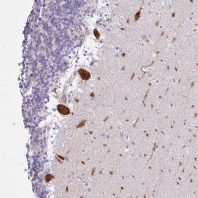 Immunohistochemistry-Paraffin: EEF1A2 Antibody [NBP2-33983]