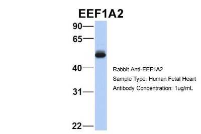Western Blot: EEF1A2 Antibody [NBP1-55245]