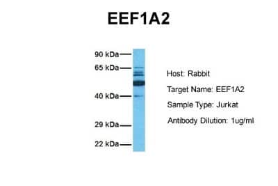 Western Blot: EEF1A2 Antibody [NBP1-55245]