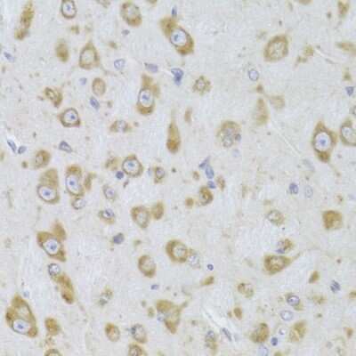 Immunohistochemistry-Paraffin: EEF1B2 Antibody - BSA Free [NBP2-92964]