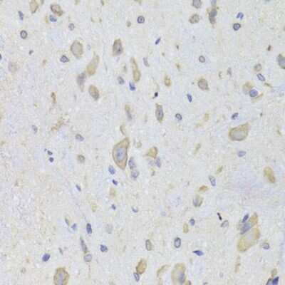 Immunohistochemistry-Paraffin: EEF1B2 Antibody - BSA Free [NBP2-92964]