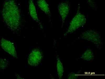 Immunocytochemistry/ Immunofluorescence: EEF1D Antibody (4B12) [H00001936-M04]