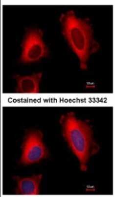 Immunocytochemistry/ Immunofluorescence: EEF1D Antibody [NBP2-16273]
