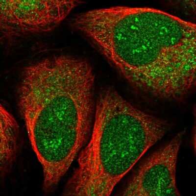 Immunocytochemistry/ Immunofluorescence: EEF1D Antibody [NBP2-56820]