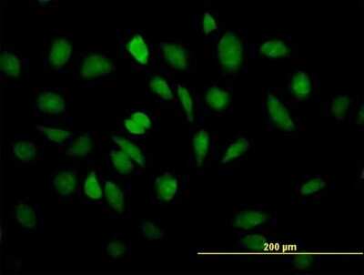 Immunocytochemistry/ Immunofluorescence: EEF1E1 Antibody [H00009521-B01P]