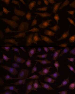 Immunocytochemistry/ Immunofluorescence: EEF1E1 Antibody - Azide and BSA Free [NBP2-92227]