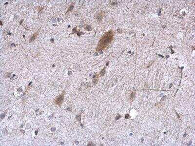Immunohistochemistry-Paraffin: EEF1E1 Antibody [NBP1-32184]