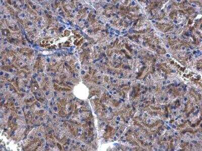 Immunohistochemistry-Paraffin: EEF1E1 Antibody [NBP1-32184]