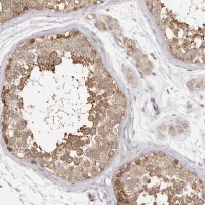 Immunohistochemistry-Paraffin: EEF1E1 Antibody [NBP1-89186]