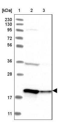 Western Blot: EEF1E1 Antibody [NBP1-89186]