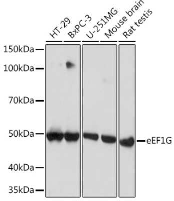 Western Blot: EEF1G Antibody (2E1O7) [NBP3-16694]