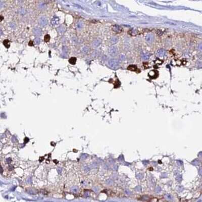 Immunohistochemistry-Paraffin: EEF1G Antibody [NBP1-91862]