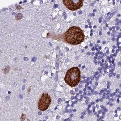 Immunohistochemistry-Paraffin: EEF1G Antibody [NBP1-91862]