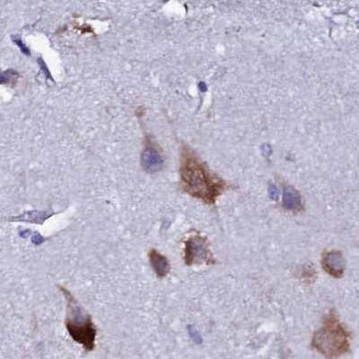 Immunohistochemistry-Paraffin: EEF1G Antibody [NBP1-91862]