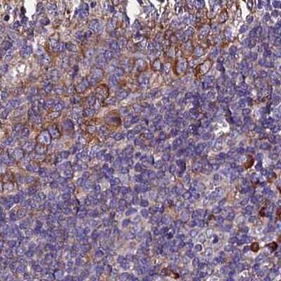 Immunohistochemistry-Paraffin: EEF1G Antibody [NBP1-91862]