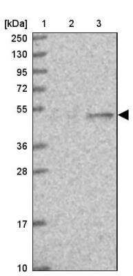 Western Blot: EEF1G Antibody [NBP1-91862]