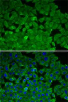 Immunocytochemistry/ Immunofluorescence: EEF2K Antibody - BSA Free [NBP2-92950]