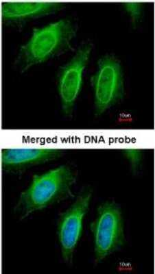 Immunocytochemistry/ Immunofluorescence: EEN Antibody [NBP1-33545]