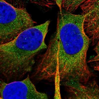 Immunocytochemistry/ Immunofluorescence: EEN Antibody [NBP1-85522]