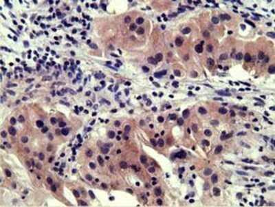 Immunohistochemistry: EEN Antibody (OTI2F5) - Azide and BSA Free [NBP2-71279]
