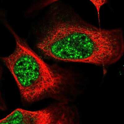 Immunocytochemistry/ Immunofluorescence: EEPD1 Antibody [NBP2-58531]