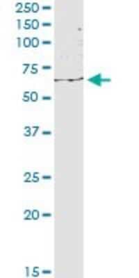 Western Blot: EEPD1 Antibody [H00080820-B03P]