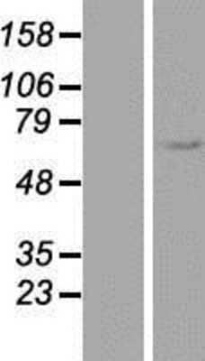 Western Blot: EEPD1 Overexpression Lysate [NBP2-06201]