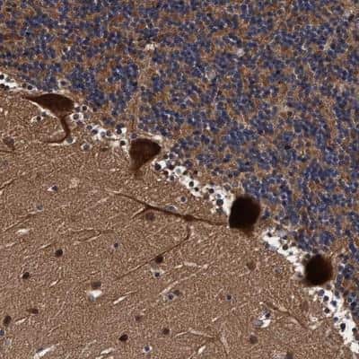 Immunohistochemistry-Paraffin: EFCAB13 Antibody [NBP1-83455]