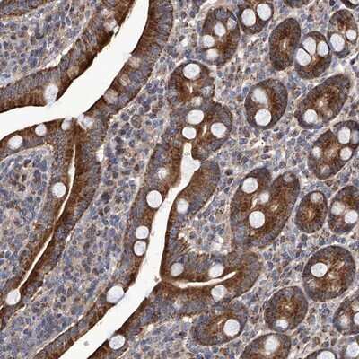 Immunohistochemistry-Paraffin: EFCAB2 Antibody [NBP1-81220]