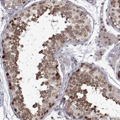 Immunohistochemistry: EFCAB3 Antibody [NBP2-48861]