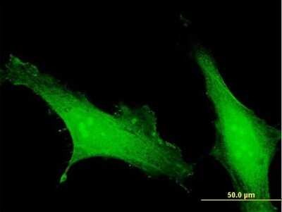 Immunocytochemistry/ Immunofluorescence: EFCAB4B Antibody [H00084766-B01P]