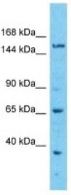 Western Blot: EFCAB5 Antibody [NBP3-10768]