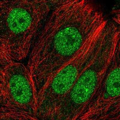 Immunocytochemistry/ Immunofluorescence: EFCAB6 Antibody [NBP1-84237]