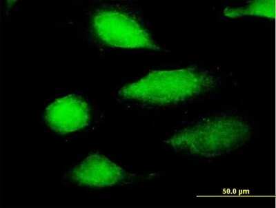 Immunocytochemistry/ Immunofluorescence: EFCBP2 Antibody [H00054550-B01P]