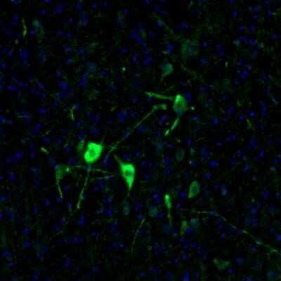 Immunohistochemistry: EFCBP2 Antibody [NBP1-84002]