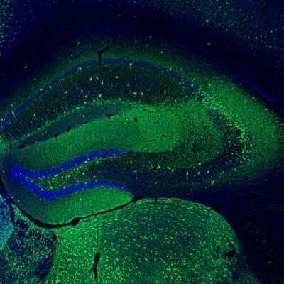 Immunohistochemistry: EFCBP2 Antibody [NBP1-84002]