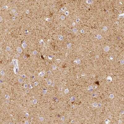 Immunohistochemistry-Paraffin: EFCBP2 Antibody [NBP1-84001]
