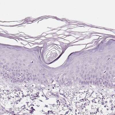Immunohistochemistry-Paraffin: EFCBP2 Antibody [NBP1-84001]