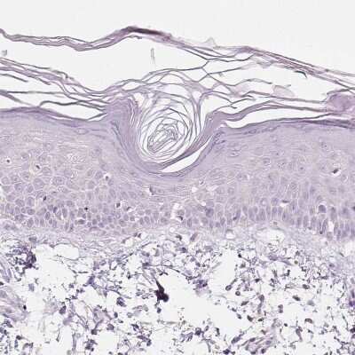 Immunohistochemistry-Paraffin: EFCBP2 Antibody [NBP1-84002]