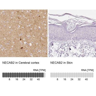 Immunohistochemistry-Paraffin: EFCBP2 Antibody [NBP1-84002]