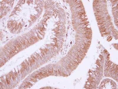Immunohistochemistry-Paraffin: Fibulin-3/EFEMP1 Antibody [NBP2-16277]