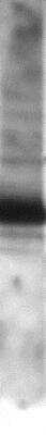 Western Blot: Fibulin-3/EFEMP1 Antibody [NB300-691]
