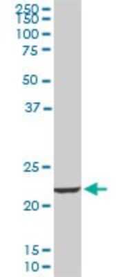 Western Blot: EFHD1 Antibody (1A8) [H00080303-M09]