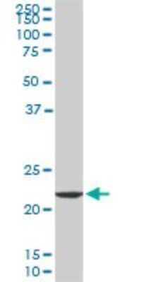 Western Blot: EFHD1 Antibody (1A8) [H00080303-M09]