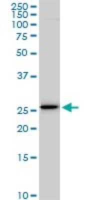 Western Blot: EFHD1 Antibody (1H7) [H00080303-M05]