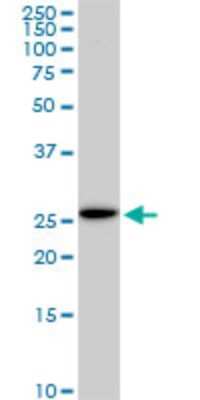 Western Blot: EFHD1 Antibody (1H7) [H00080303-M05]