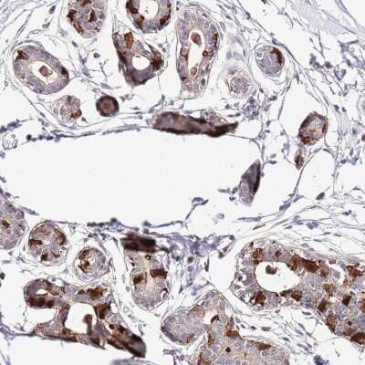 Immunohistochemistry-Paraffin: EFHD1 Antibody [NBP2-33281]