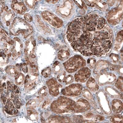 Immunohistochemistry-Paraffin: EFHD1 Antibody [NBP2-33281]