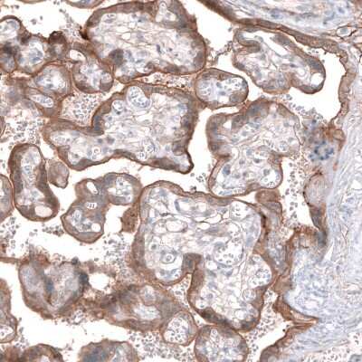 Immunohistochemistry-Paraffin: EFHD1 Antibody [NBP2-33281]