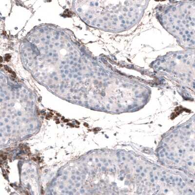 Immunohistochemistry-Paraffin: EFHD1 Antibody [NBP2-33281]